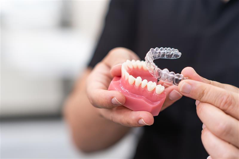 Clear aligners in Dallas texas