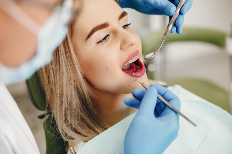 Dental veneers process
