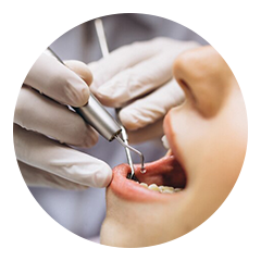 Dental crowns