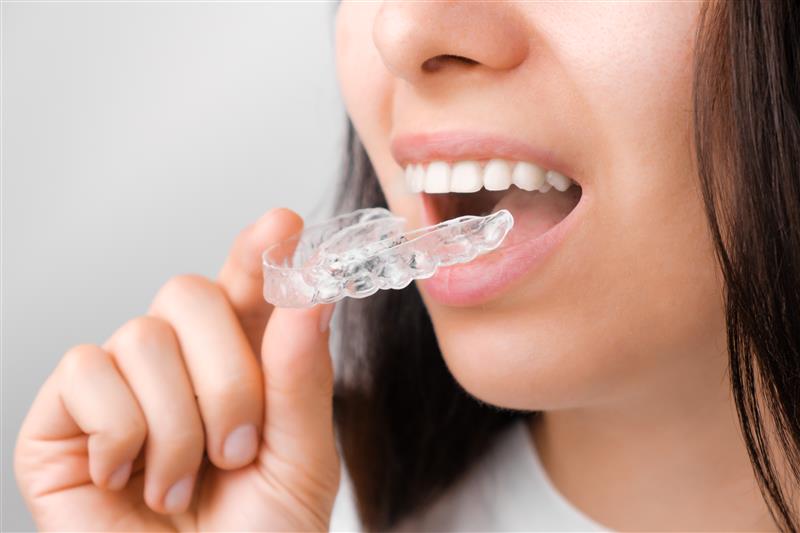 Invisalign Clear aligners